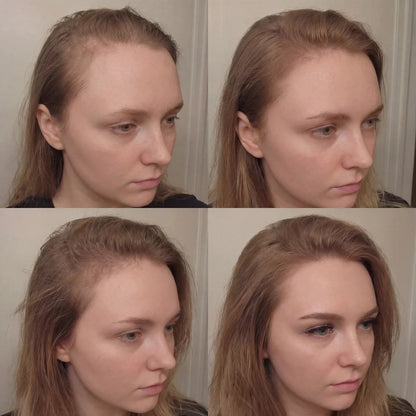 Hair Growth Serum Roll-On