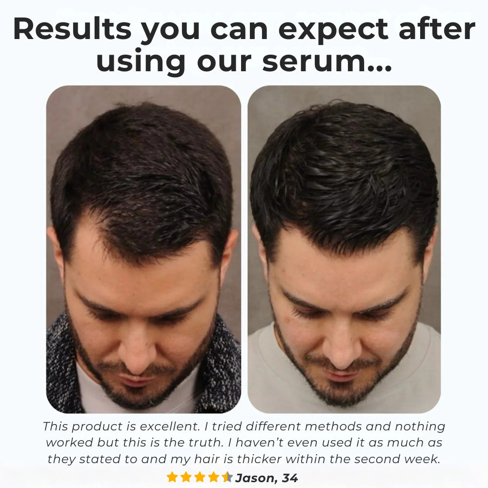 Hair Growth Serum Roll-On