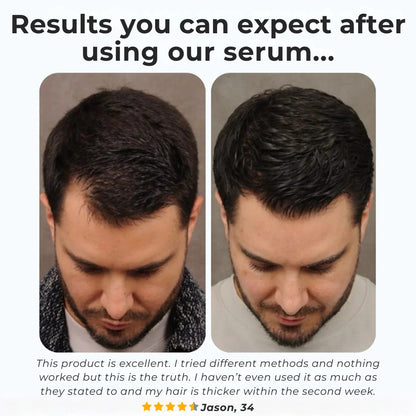Hair Growth Serum Roll-On