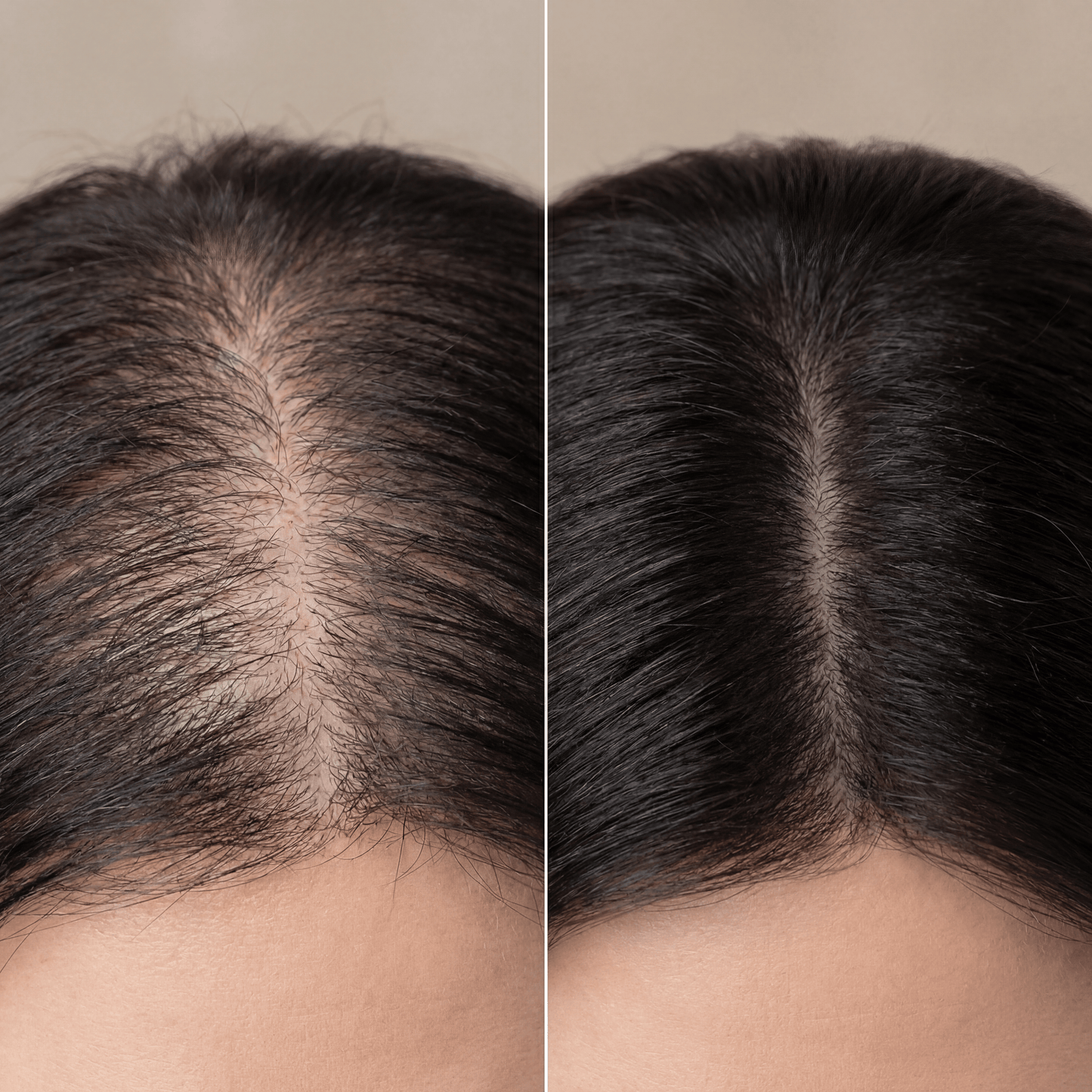 Hair Growth Serum Roll-On