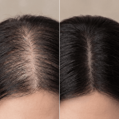 Hair Growth Serum Roll-On